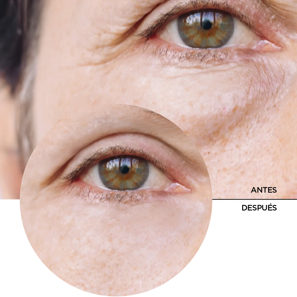 2311 👁️✨ SOLO Sérum Contorno de Ojos con Cafeína 5% REVOX (30 ml) - PB4-0026