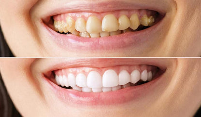 12215 🦷 Crema Dental Oral-B Extra Blancura con Bicarbonato 58 ml ✨