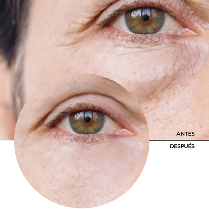 2311 👁️✨ SOLO Sérum Contorno de Ojos con Cafeína 5%  REVOX (30 ml) - PB4-0026